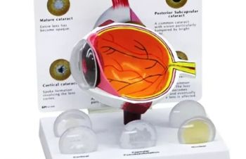 Учебная модель глаза катаракта офтальмолог офтальмоскоп, Днепр